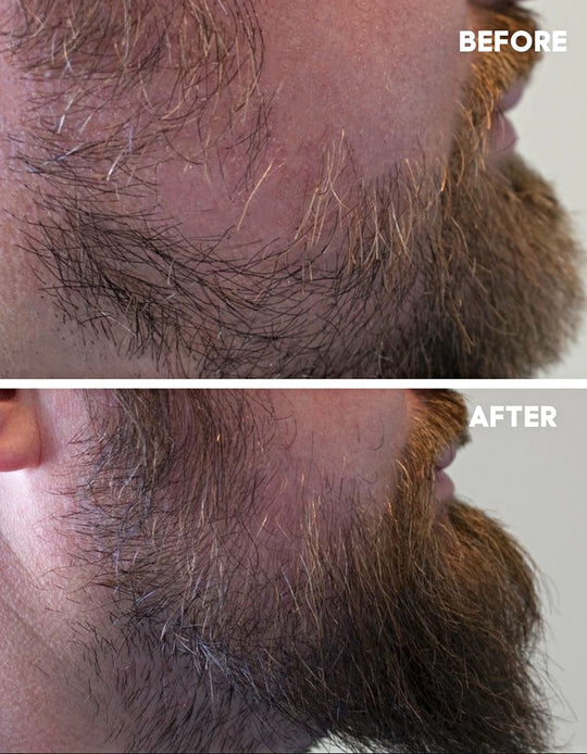 Hår og Skjegg Serum 100ml