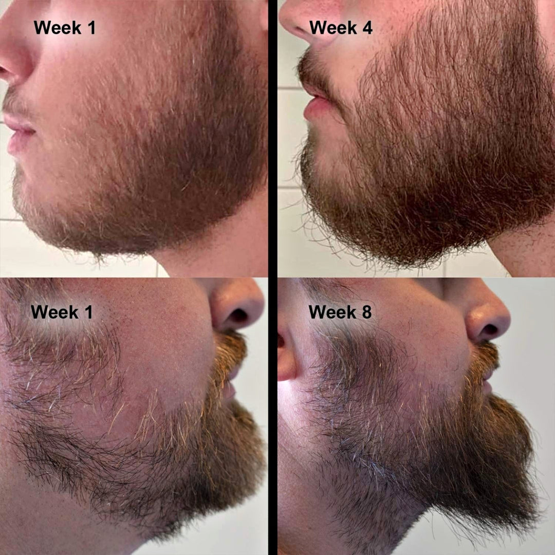 Hår og Skjegg Serum 100ml