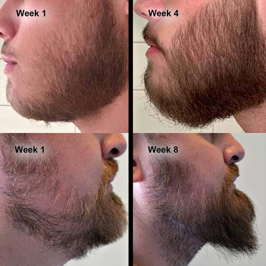 Hår og Skjegg Serum 100ml